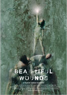 Beautiful Wounds